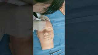 Operation method and instructions for eyebrow lifting in PDO [upl. by Auj]