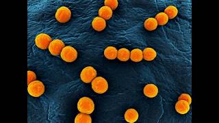 Enterococcus faecalis [upl. by Molahs228]