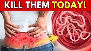 Eliminate Parasites Naturally with These POWERFUL Foods [upl. by Saticilef186]