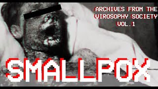 SMALLPOX  Archives from the Virosophy Society Vol 1 Analog Horror [upl. by Renckens]