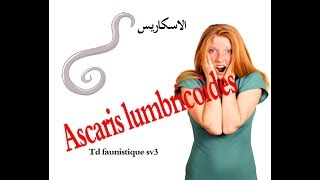 TD faunistique  Ascaris lumbricoides b DARIJA sv3 لاينصح به أصحاب القلوب الضعيفة [upl. by Denoting]