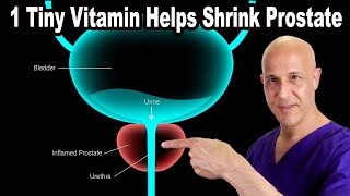 1 Tiny Vitamin Helps Shrink Your Enlarged Prostate  Dr Mandell [upl. by Uyr]