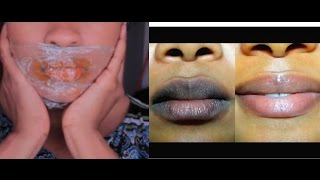 HYPERPIGMENTATION AUX LEVRES VOICI LA REPONSE A VOTRE PROBLEM [upl. by Kay136]