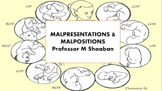 Malpresentations amp Malpositions [upl. by Arenat]