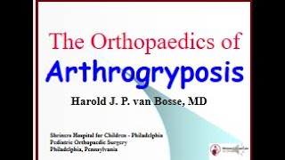 The Orthopaedics of Arthrogryposis by Dr Harold vanBosse [upl. by Idaf795]