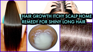 How To Grow Long Hair treat Itchy Scalp Get Shiny Hair  SuperPrincessjo [upl. by Jr]