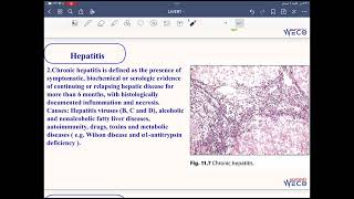 Pathology Hepatobiliary system 1 [upl. by Maleen745]