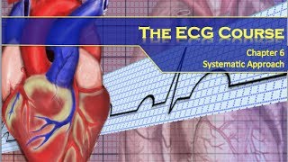 The ECG Course  Systematic Approach [upl. by Wirth]