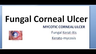 Ophthalmology 115 a Fungal Corneal Ulcer Mycotic Keratitis KeratoMycosis Eye treatment fungus anti [upl. by Stuart]