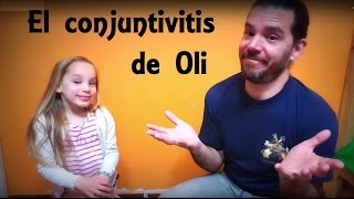 quotEl conjuntivitis de Oliquot [upl. by Alexia517]