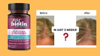 My Biotin Pro Clinical Dont Buy Until You Know This [upl. by Limemann]