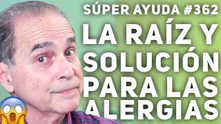 SÚPER AYUDA 362 La Raíz Y Solución Para Las Alergias [upl. by Ramgad]