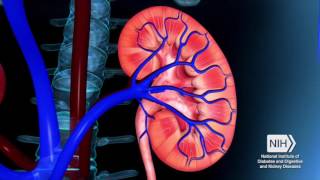 Symptoms Causes and Treatments for Kidney Infection [upl. by Eugenius]