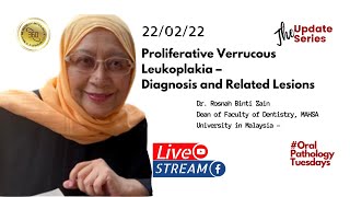 Oral Pathology Proliferative verrucous Leukoplakia – Issues in Diagnosis and its Related Lesions [upl. by Moguel42]