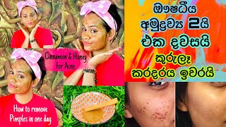 එක දවසින් කුරුලෑ නැති කරන රහස DIY CINNAMON AND HONEY MASK FOR ACNE PRONE SKIN 100 Effective [upl. by Colis935]