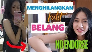 CARA MENGHILANGKAN KULIT BELANG  Clarin Hayes [upl. by Balf701]