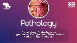 Ch5 part3 Circulatory disturbances HyperemiaCongestion Thrombosis HemorrhageShock Pathology [upl. by Craig]