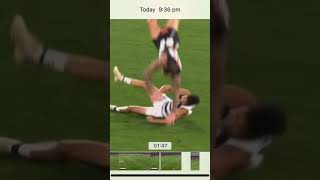 Jeremy Howe snaps his arm 2023 round 1 collingwood vs geelong [upl. by Marchal190]