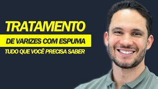 Tratamento de varizes com espuma  Tudo que você precisa saber varizes [upl. by Notsud]