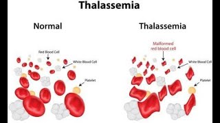 Thalassemia in Hindi [upl. by Conner]