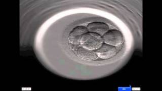 INSTITUT MARQUÈS  Ansicht der Entwicklung eines menschlichen Embryos durch das Embryoscope [upl. by Namrehs]