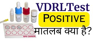 VDRL Test Hindi  VDRL test kya hota hai [upl. by Gnav]