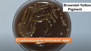 Cryptococcus neoformans colony morphology on Bird seed agar [upl. by Siegler]