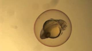 Spontaneous coiling behavior in zebrafish embryos [upl. by Simonette]