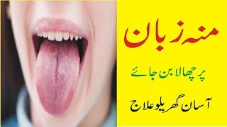 zaban aur Muh Ke Chale Khatam Karne Ka Gharelu Ilaj  Rehman Health Tips [upl. by Nosnehpets272]