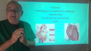 Miocardial Lesions Clase IV Isquemia Lesion e Hipertrofias cardiacas Índices y criterios [upl. by Adliwa]