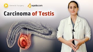 Carcinoma of Testis  Surgery  Video Tutorial  Online Classes Lecture  VLearning [upl. by Gwynne926]