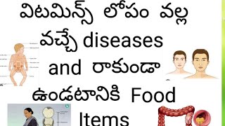 Diseases caused by vitamin deficiency [upl. by Onra]