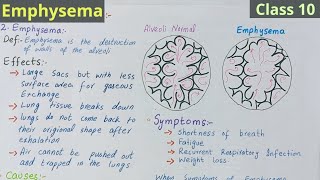 Emphysema Class 10  Emphysem Symptoms and Causes  Lec7  visiblescience22 [upl. by Yenwat]