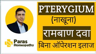 Pterygium  आँख में माँस बढ़ना नाखूना रोग Pterygium बिना ऑपरेशन ठीक करे नाखूना का इलाज हिंदी में [upl. by Notsle]