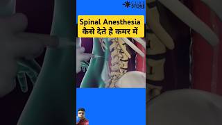 Spinal Anesthesia kaise dete hai anesthisa mbbs knowledge science shorts [upl. by Muirhead]