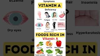 vitamin A deficiency signs and foods rich in itfood vitamin [upl. by Llekcm]