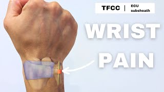 Wrist pain  TFCC  ECU subsheath rehab [upl. by Bergen]