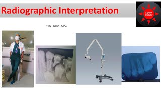 How to write dental radiographic Interpretation  Iopa  rvg  opg  Hindi language [upl. by Airat9]