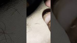 two hair removal barbersurgion barbershop hairremoval [upl. by Sarina255]