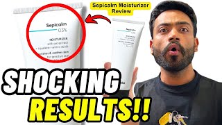 Kaash Ye Pehle Pta Hotta Yaar MINIMALIST SEPICALM 3 MOISTURIZER REVIEW skincare moisturizer [upl. by Akeryt]