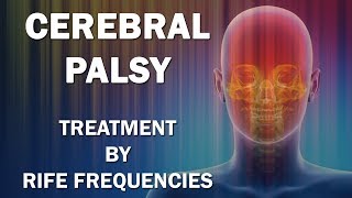 Cerebral Palsy  RIFE Frequencies Treatment  Energy amp Quantum Medicine with Bioresonance [upl. by Haidabez]