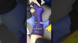 Why a Saw Can Be Safe for Cutting Casts 🛠️✨ [upl. by Cherri]