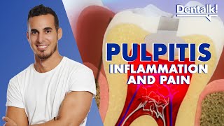 TOOTHACHE It could be PULPITIS  Tooth pain RELIEF and CAUSES of inflamed pulp  Dentalk © [upl. by Venu]