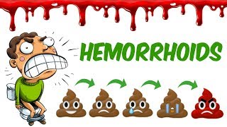 The Hemorrhoids [upl. by Cir]