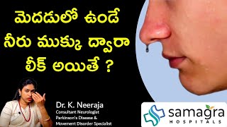 Understanding Brain Fluid Leak CSF Rhinorrhea Causes Symptoms amp Treatment  Dr Neeraja [upl. by Goth]