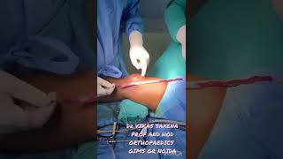 Central quadriceps tendon graft harvest [upl. by Alley]