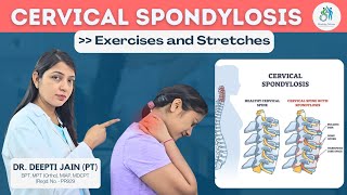 Cervical Spondylosis Exercises Neck Pain Exercises Neck Exercises [upl. by Aneehsram]