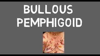 Bullous pemphigoid [upl. by Alien]