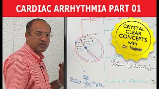 Cardiac Arrhythmia  Part 13 [upl. by Arand319]