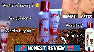 how to use eventone c face cream  even tone 4 face wash [upl. by Ittam921]